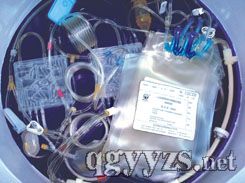 一次性使用袋式血細(xì)胞分離器