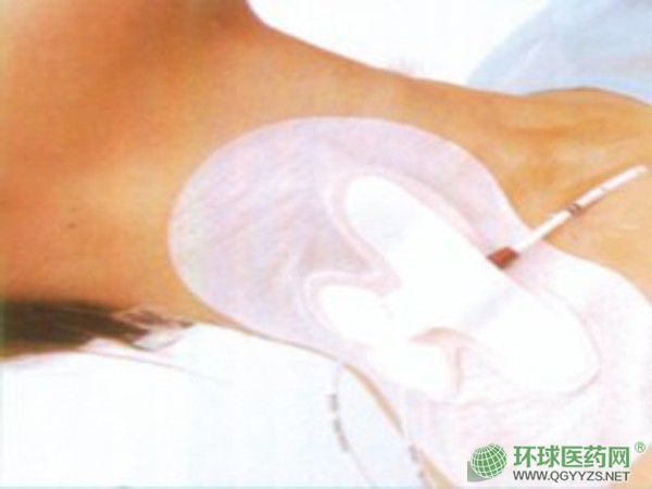 醫(yī)療器械乳膏凝膠代加