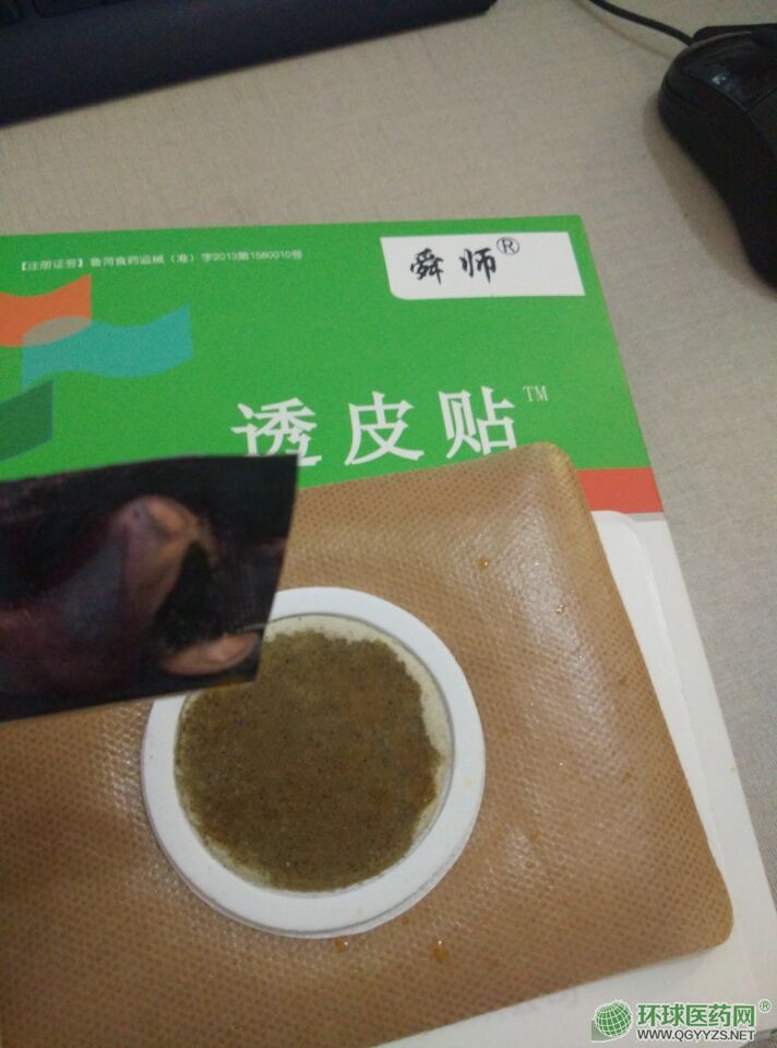 ɳ����͸Ƥ�N���a(ch��n)�S���N�ƴ��ӹ��S�����l(f��)